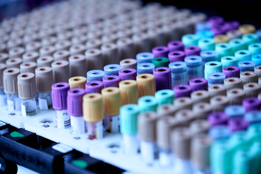 Vacutainer tubes used in Covid-19 detection.